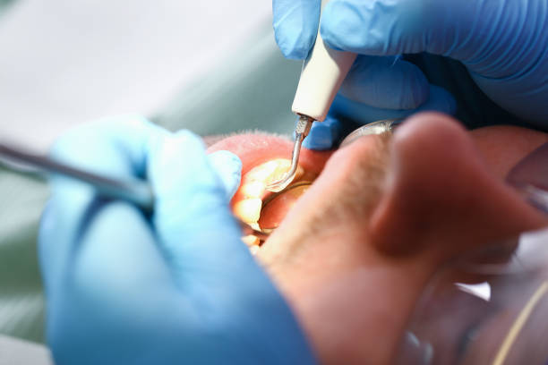 Best Chipped Tooth Repair Near Me  in Tinley Park, IL